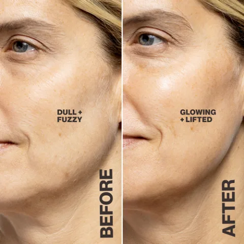 Before and after image showing change in radiance of skin