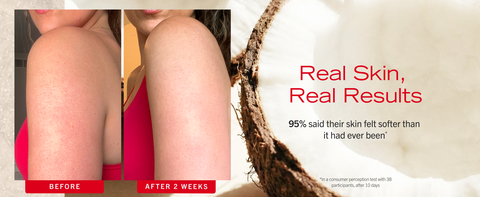Skin before and after using KP Body Scrub to remove skin bumps