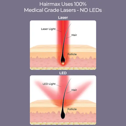 lasers vs leds