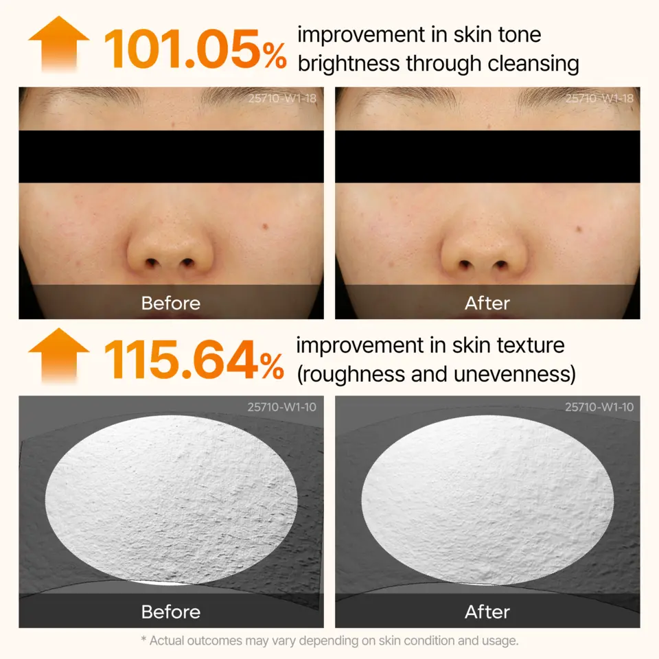 Peel Shot Exfoliating Kojic Acid Turmeric Serum