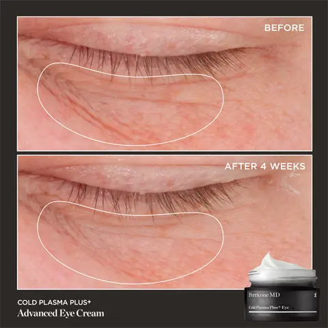 RESULTS YOU CAN SEE Before & After