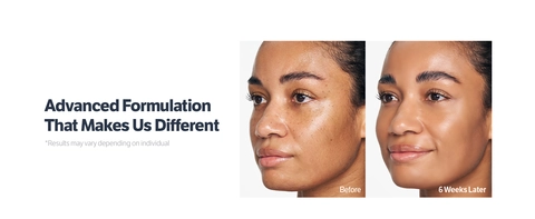 Niacin Kojic Acid Brightening Gel Cleanser