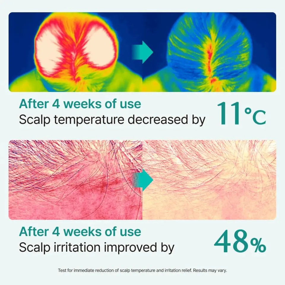 Scalp:Turn Cica PDRN Brush Ampoule