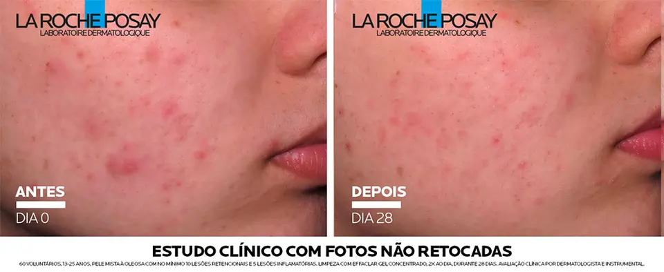 Effaclar Concentrado 3