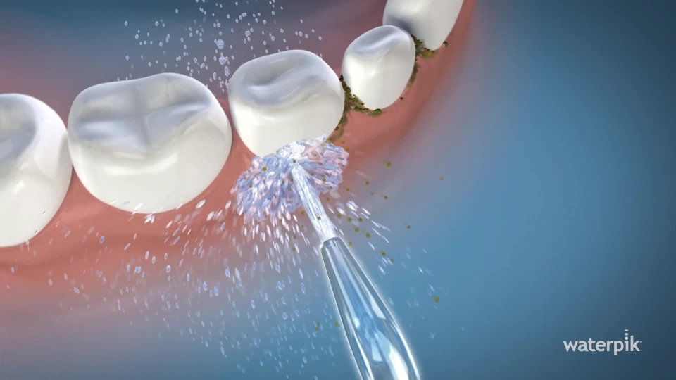 Waterpik Tips Storage Case with 6 Tips