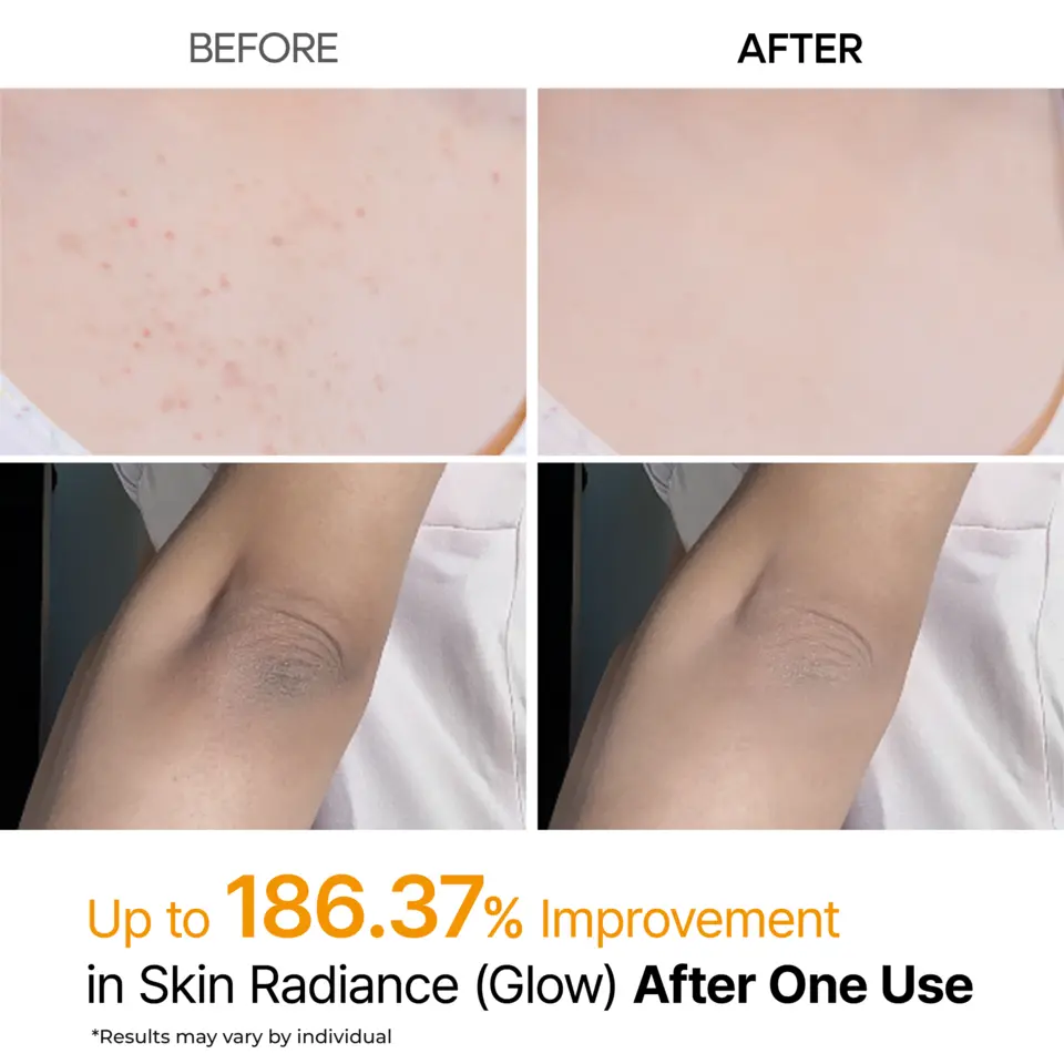 Peel Shot Exfoliating Kojic Acid Turmeric Spray