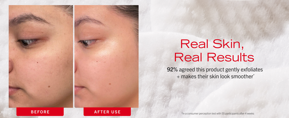 Skin before and after using Facial radiance pads showing luminous glow