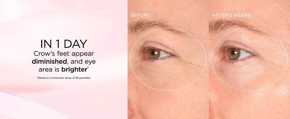 Retinol + HPR Eye