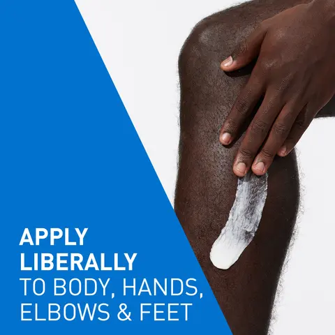 Apply liberally as often as needed, or as directed by a physician.  Suitable for use on the body, including hands, elbows, knees, heels, and feet.  Avoid direct contact with eyes. If contact occurs, rinse thoroughly with water.