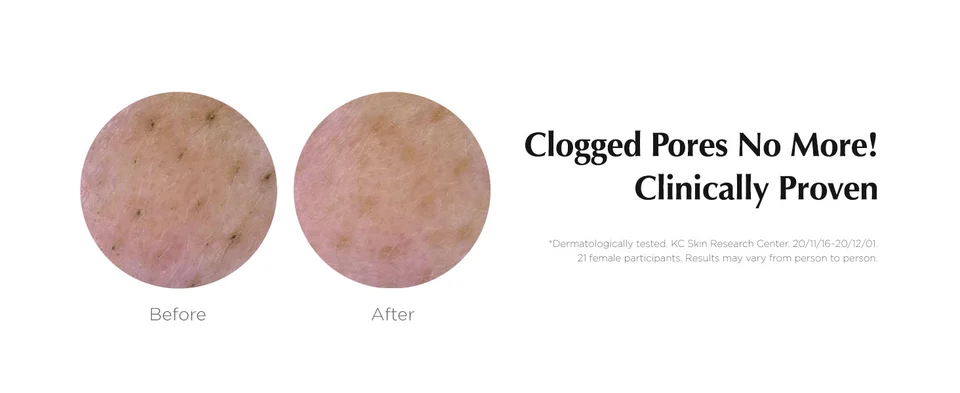 No more clogged pores