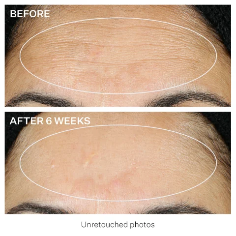 PROVEN RESULTS