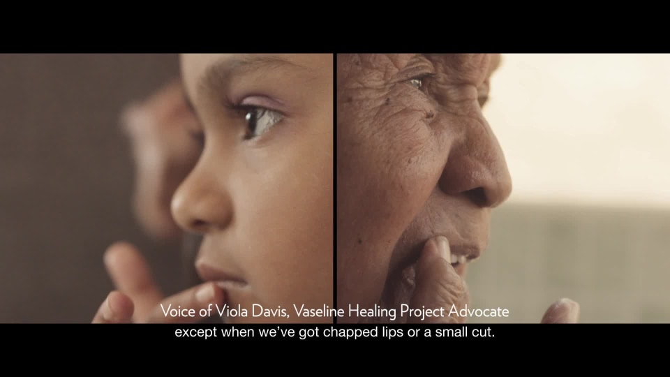 thumbnail video image 2 of Vaseline Intensive Care Spray Lotion Essential Healing 6.5 oz, 2 of 3