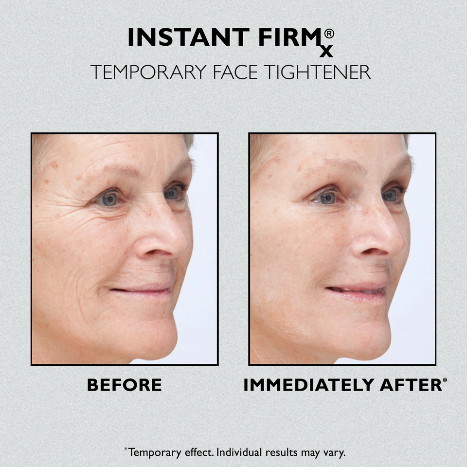 FirmX Face Tightener Before and After