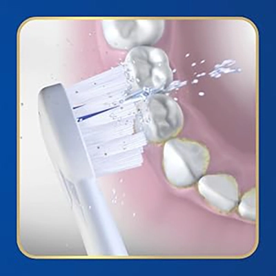 Using Sonic-Fusion 2.0 Floss Mode