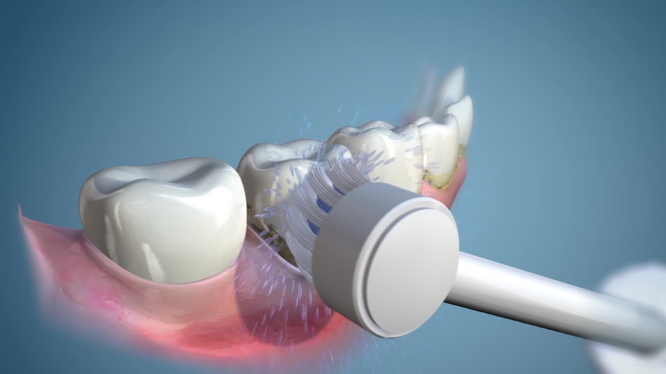 Waterpik TB100E Toothbrush Replacement Tips