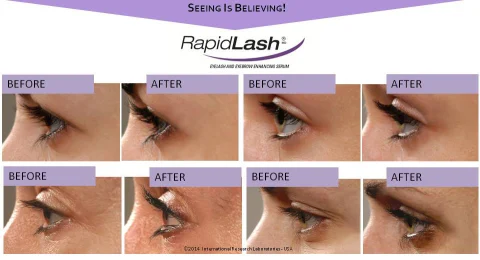 Before and After Photos