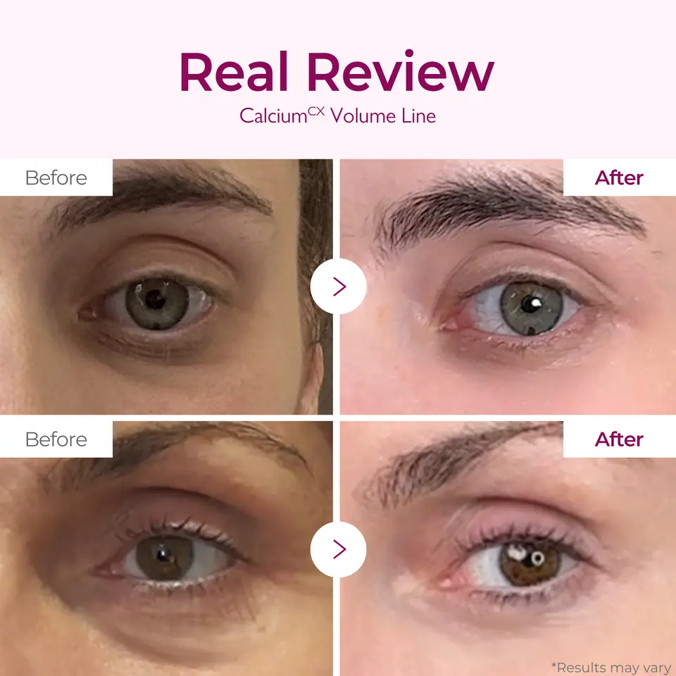 Calcium Volume Cream