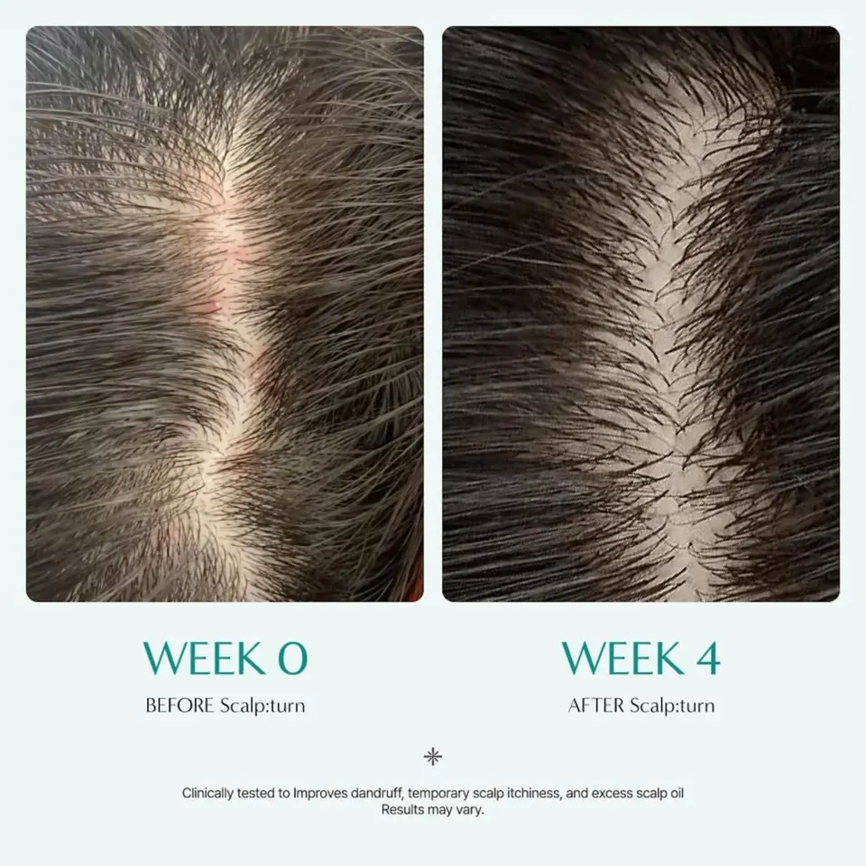 Scalp:Turn Cica PDRN Brush Ampoule