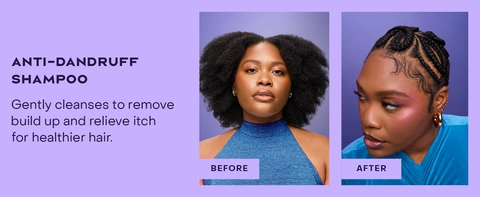 2 images of the same woman before &amp; after applying our treatment for healthy-looking hair.