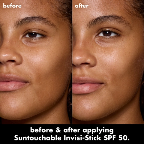 Before and After model image