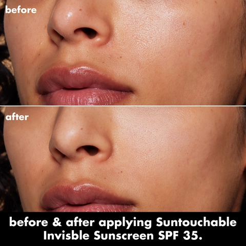 Before and After model image