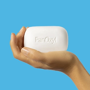 A hand holding Acne Treatment Bar