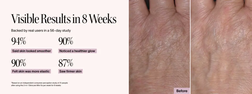 Before and after images showing smoother-looking skin texture over time.