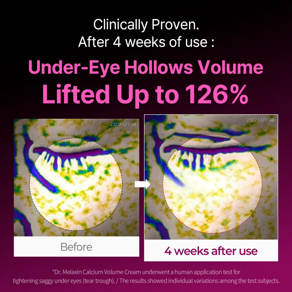Calcium Volume Cream
