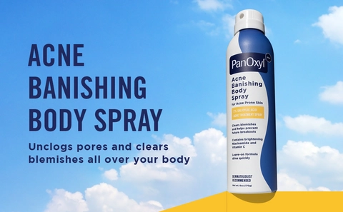 Acne Banished Body Spray. Unclogs pores and clears blemishes all over your body.