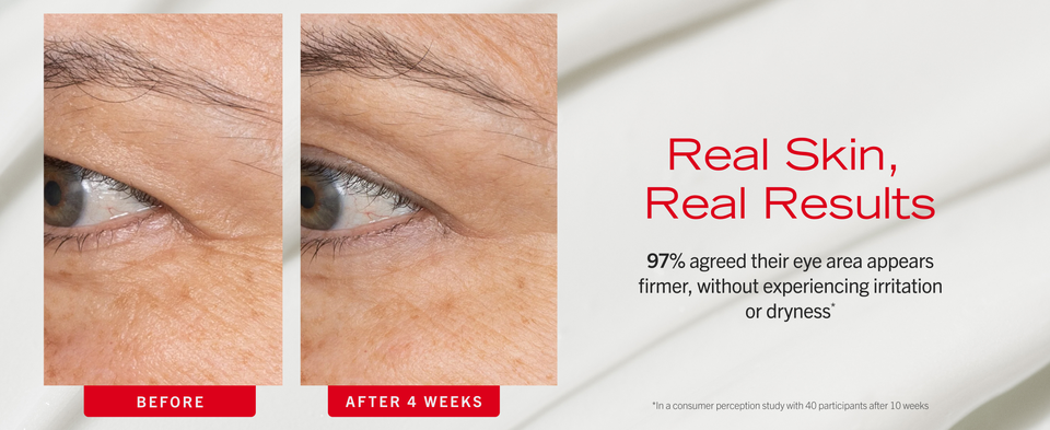 Under eye area before and after using retinol eye cream showing reduced fine lines