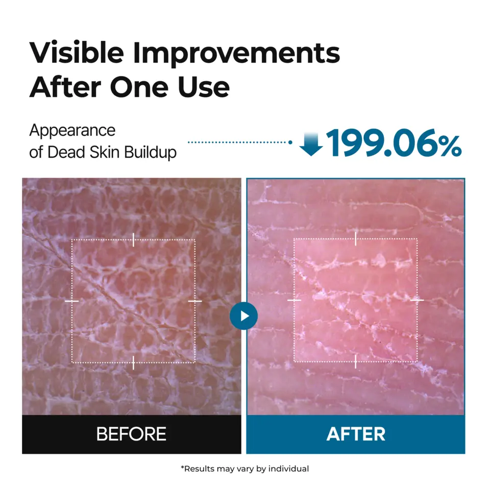 Peel Shot Exfoliating TX-Spray