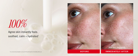 Skin before and after using oat milk essence, showing hydrating glowing skin