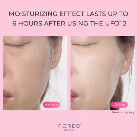 Moisturizing Effects Before And After