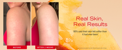 Skin before and after using KP Body bump eraser scrub