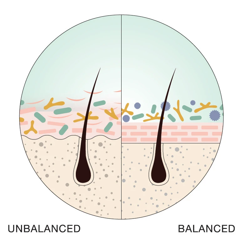 graphic of a scalp that is balanced and unbalanced