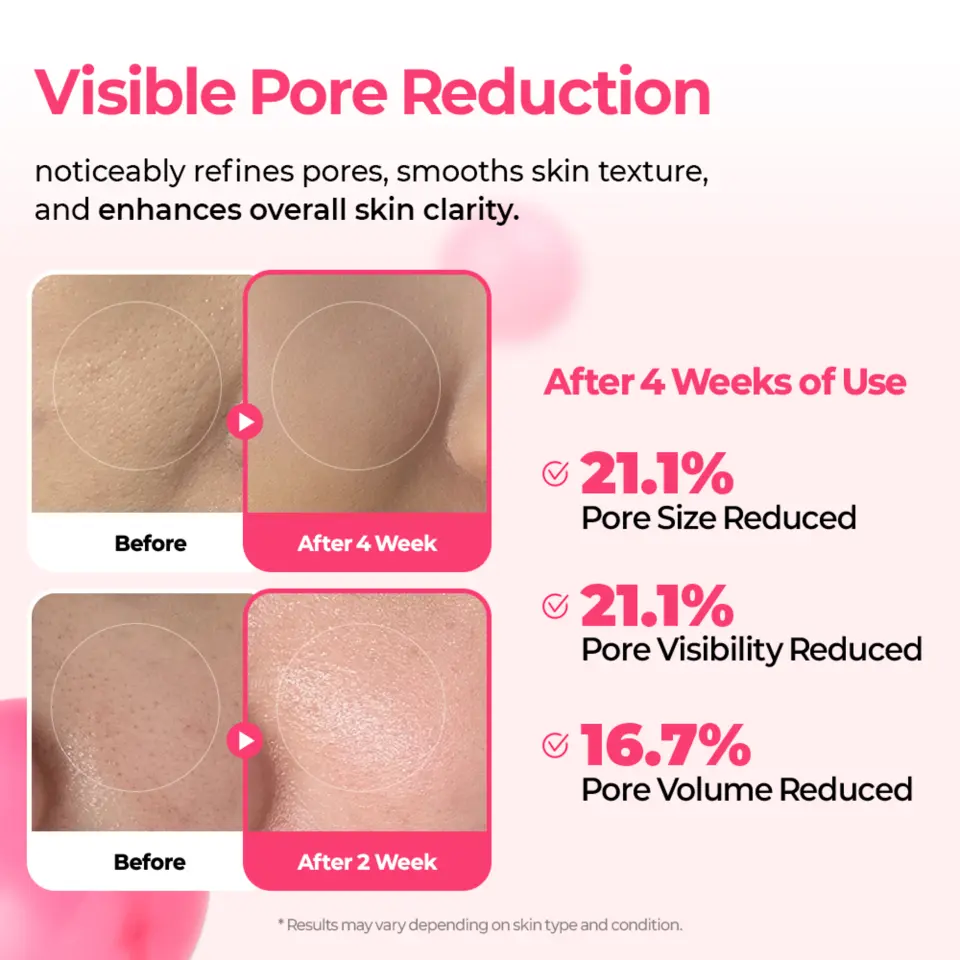Cyano Pink Spicule Serum