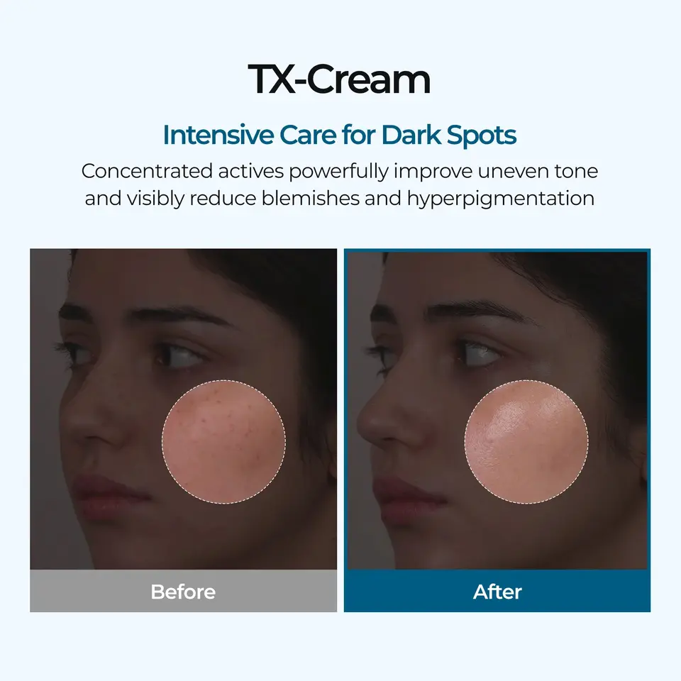 TX-Cream
