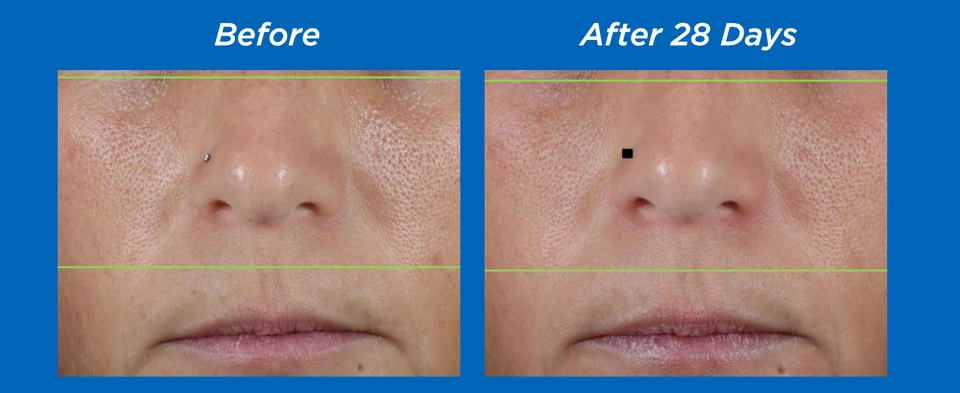 Before &amp; After