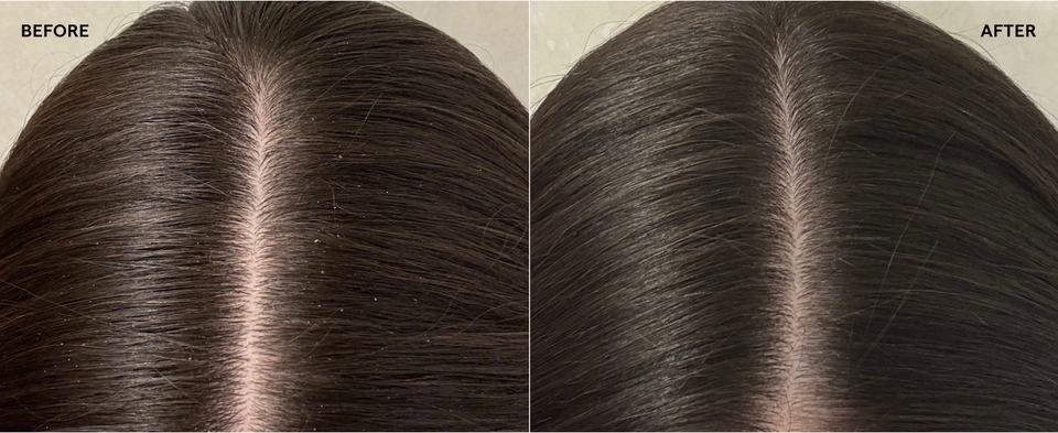 Close-up comparison of hair before and after treatment, showing improved condition.