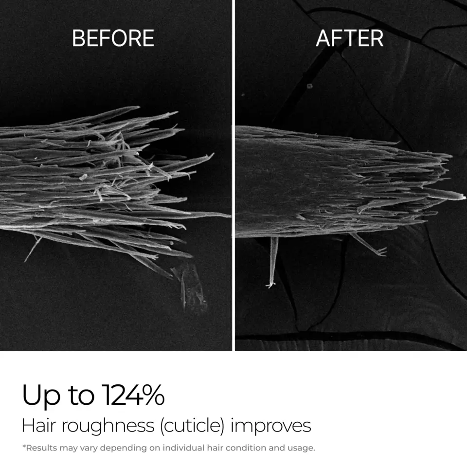 Bondex Protein Bonding Remodeling Clinic