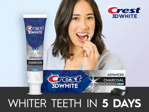 Whiter teeth in 5 days