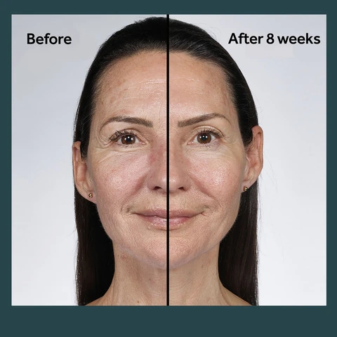 damage, before, after, fine lines, wrinkles, weeks, results, uneven skin tone, uneven texture