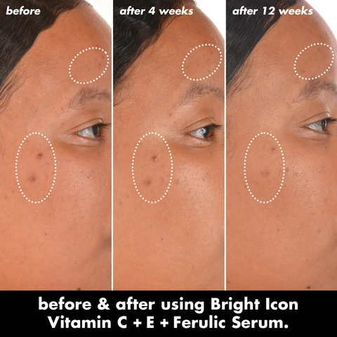 B+A model image applying Bright Icon Vitamin C + E + Ferulic Face Serum