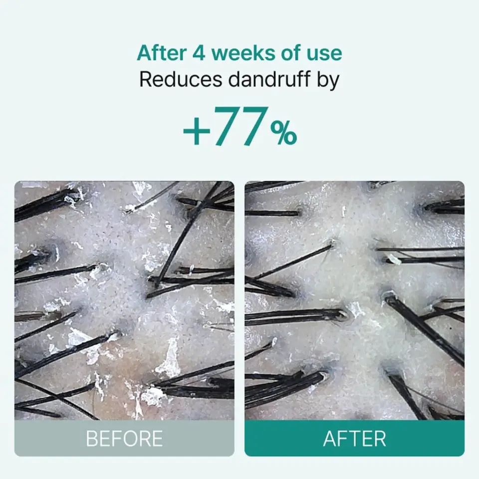 Scalp:Turn Cica PDRN Brush Ampoule