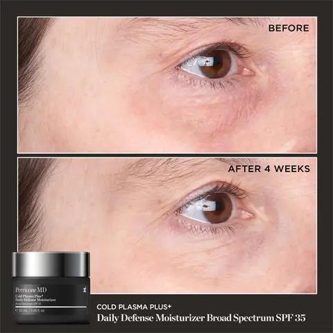 Cold Plasma Plus+ Daily Defense Moisturizer SPF 30 B&amp;A