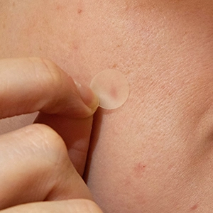 A person applying a translucent circular patch to their face