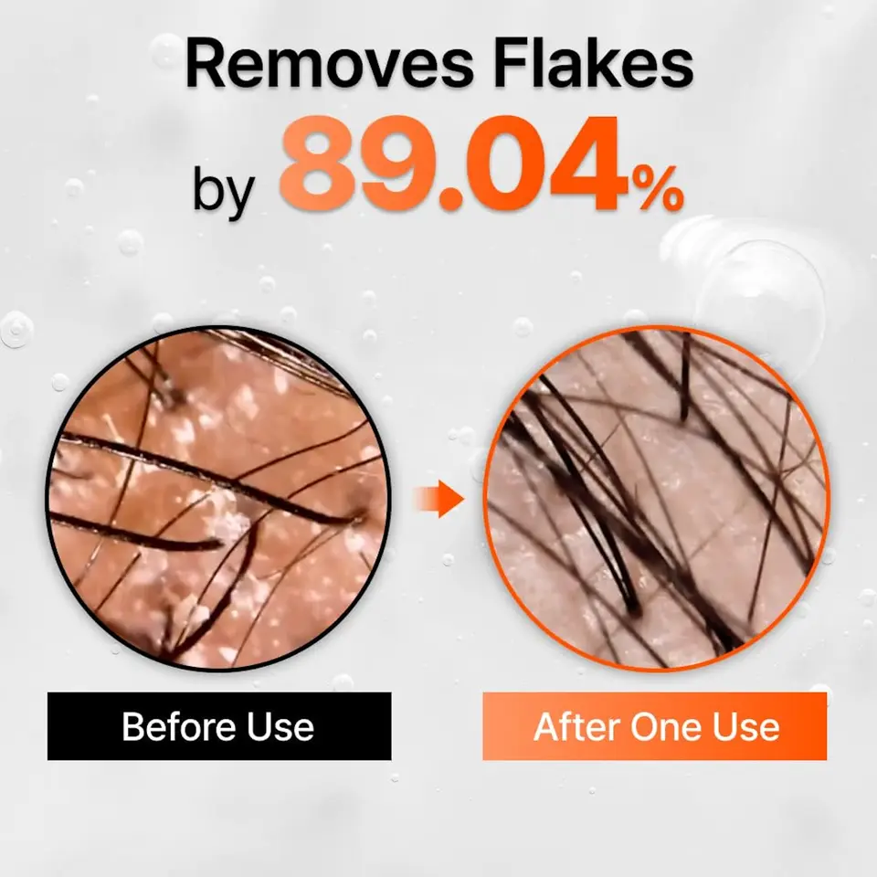 Grow:Turn Exosome Brush Ampoule