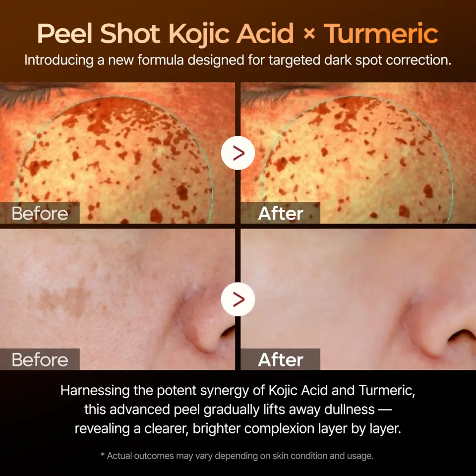 Peel Shot Exfoliating Kojic Acid Turmeric Serum