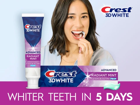 Whiter teeth in 5 days