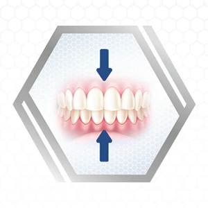 Step 3: Place the denture in your mouth